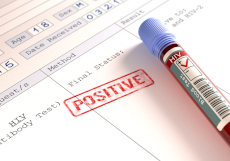 HIV Positive - Image from Colourbox.com (Supplier Kiyoshi Takahase Segundo)